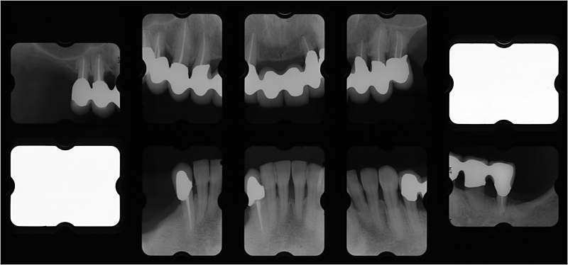 sy04X-ray+1