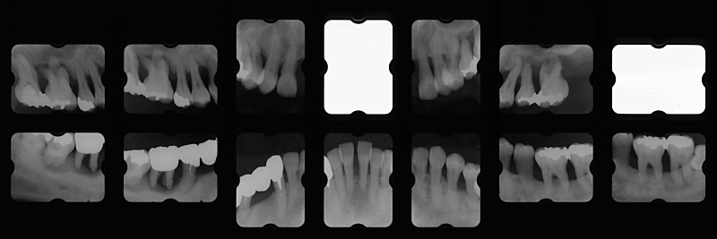 sy03X-ray+1