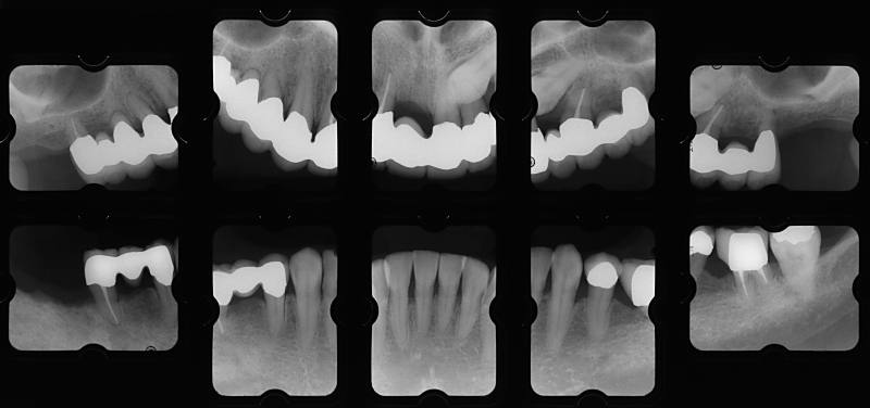 sy02X-ray+1