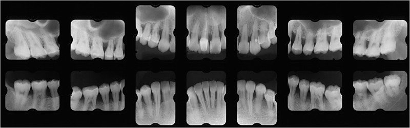 sy08X-ray+1