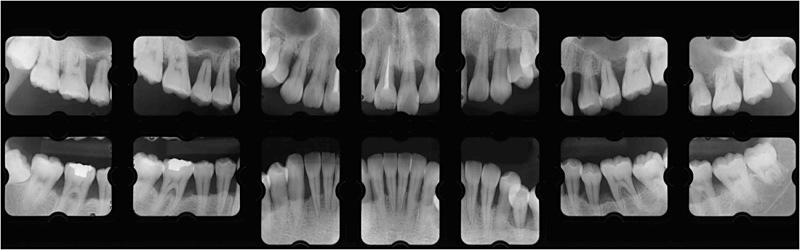 sy07X-ray+1